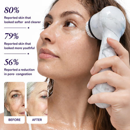 Soniclear Facial Cleansing Brush – Sonic, Antimicrobial, 4 Speeds