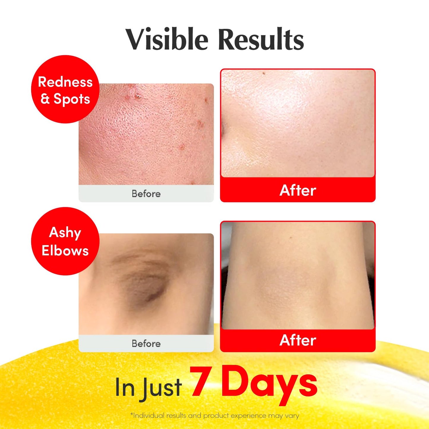 Vitamin C Brightening Face Serum with Niacinamide