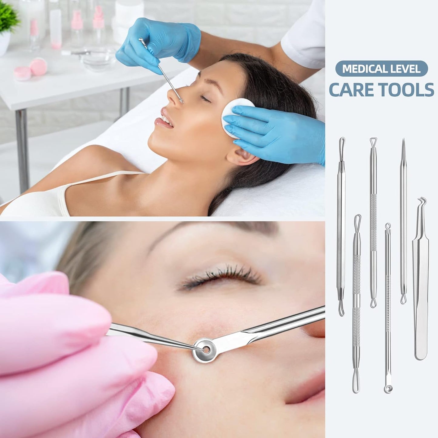 Stainless Steel Blackhead Remover Comedone Extractor Kit