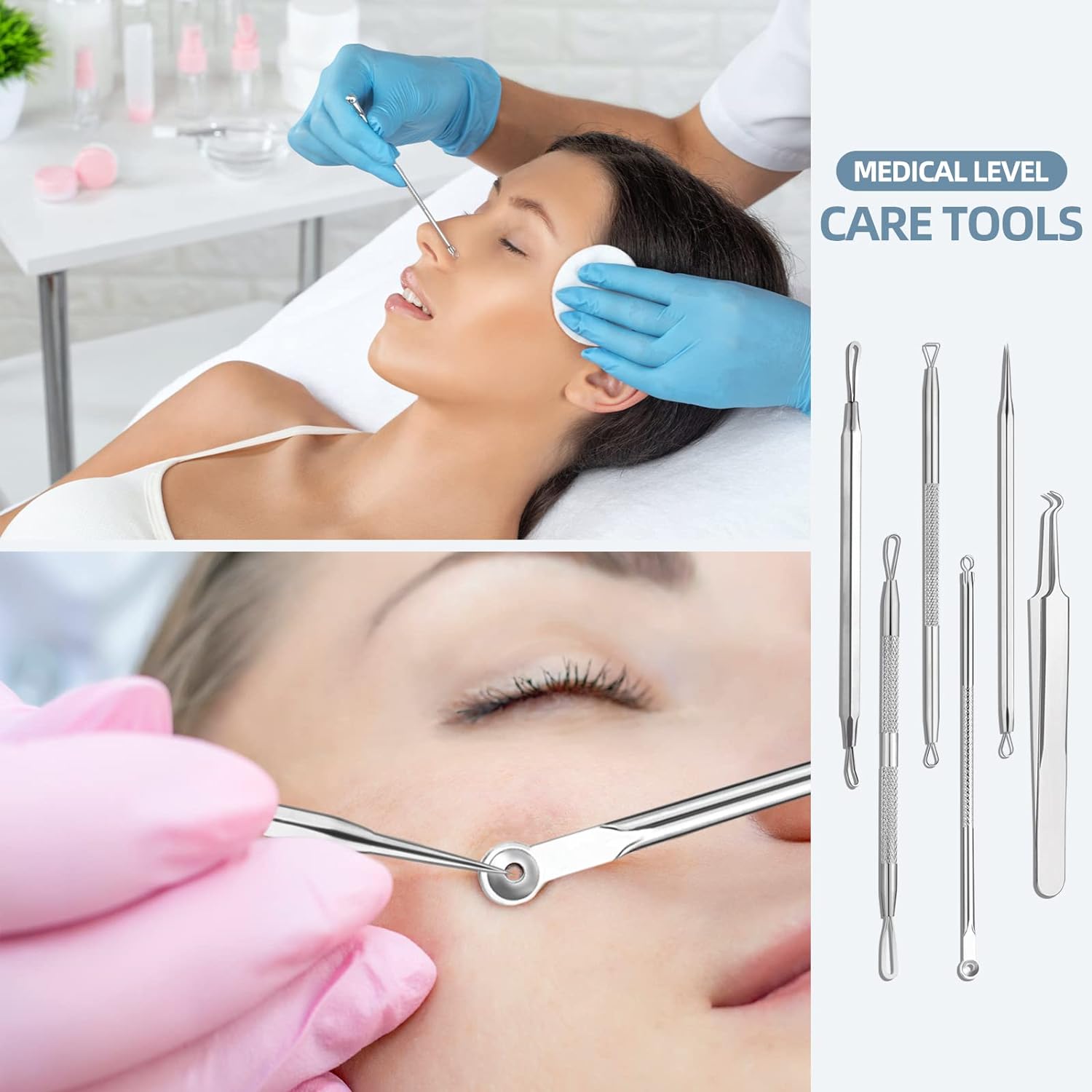 Stainless Steel Blackhead Remover Comedone Extractor Kit