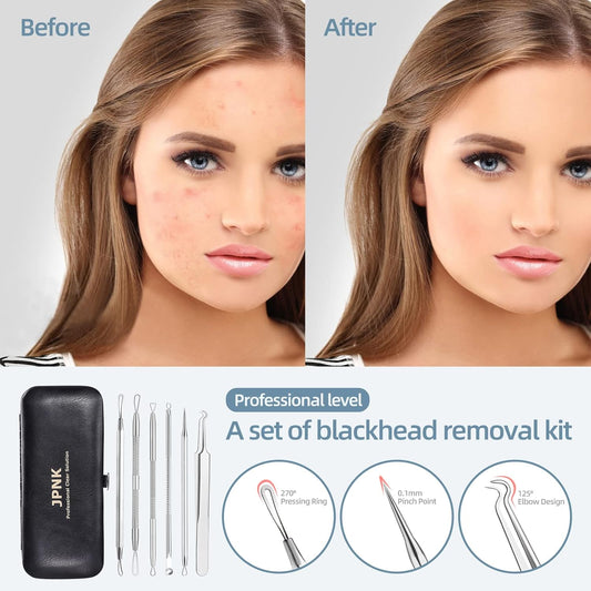 Stainless Steel Blackhead Remover Comedone Extractor Kit