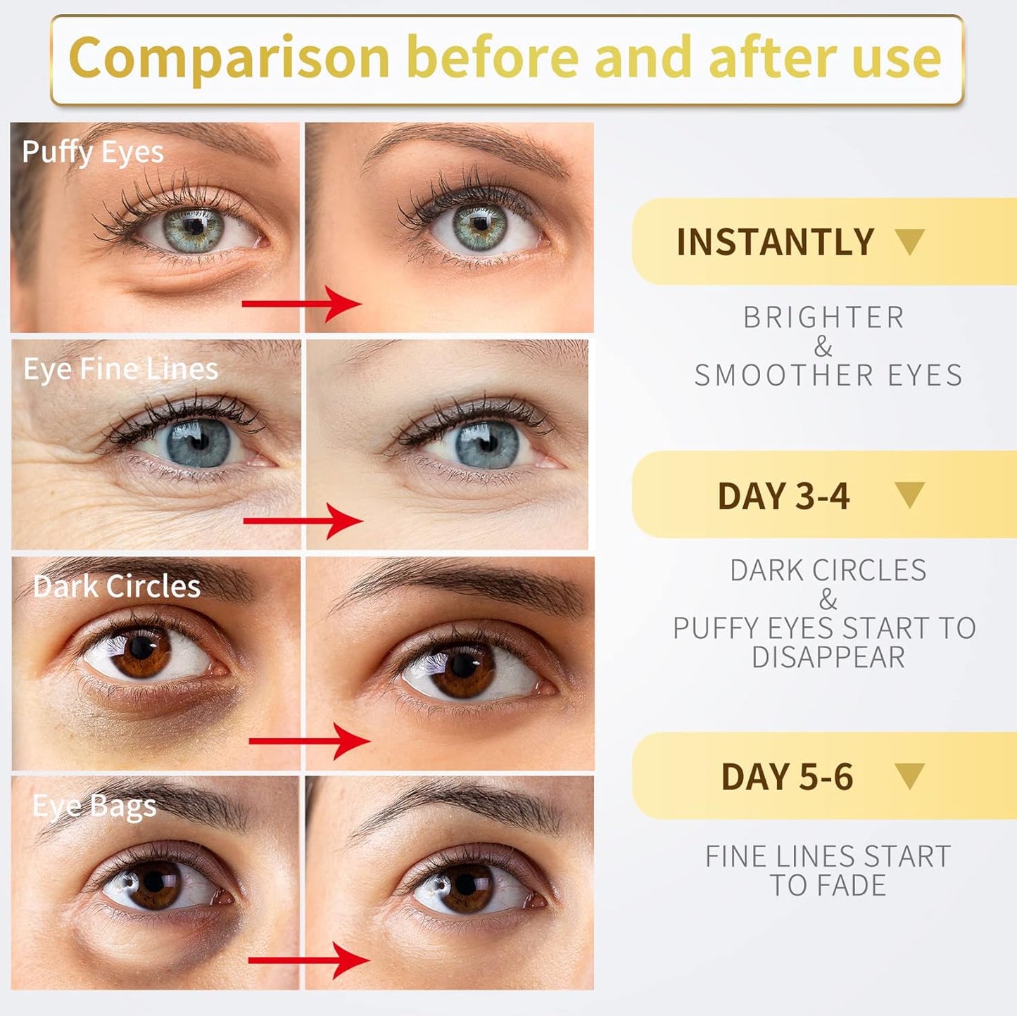 24K Gold Under Eye Patches with Hyaluronic Acid, 60-Count