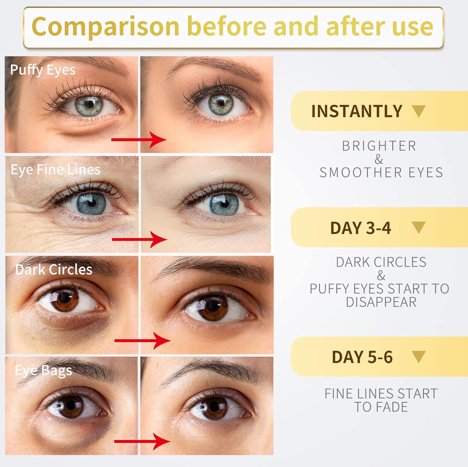 24K Gold Under Eye Patches with Hyaluronic Acid, 60-Count