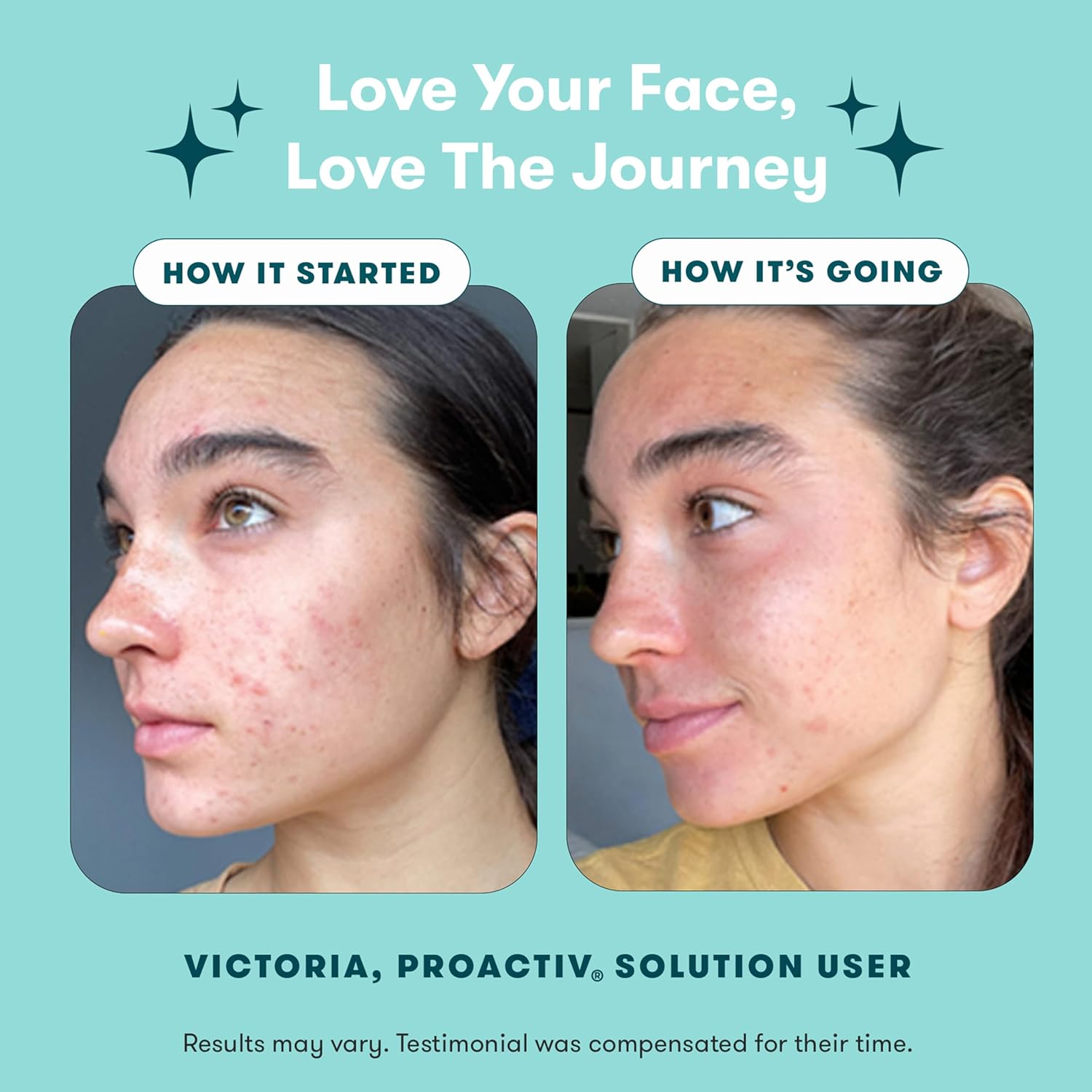 3-Step Acne Treatment Kit with Benzoyl Peroxide