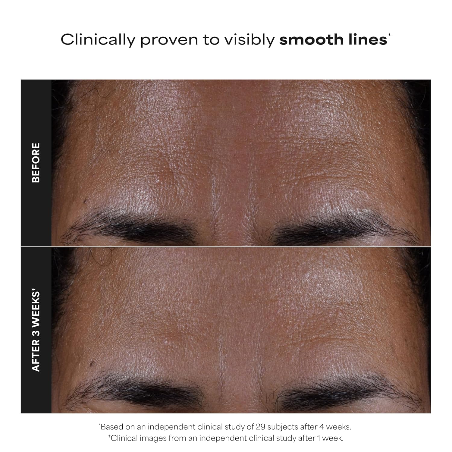2% BHA Liquid Exfoliant for Clear, Smoother Skin