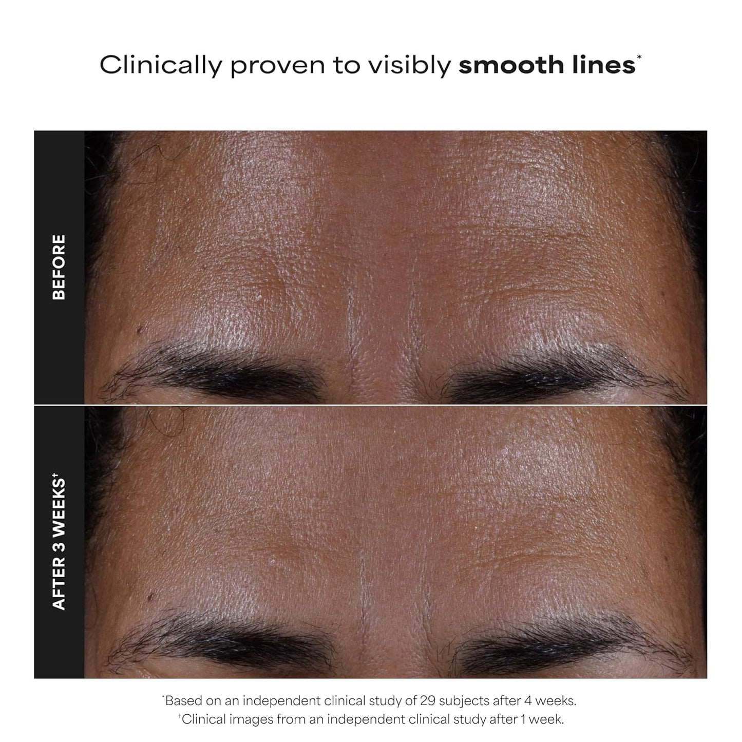 2% BHA Liquid Exfoliant for Clear, Smoother Skin