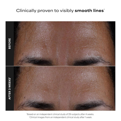 2% BHA Liquid Exfoliant for Clear, Smoother Skin