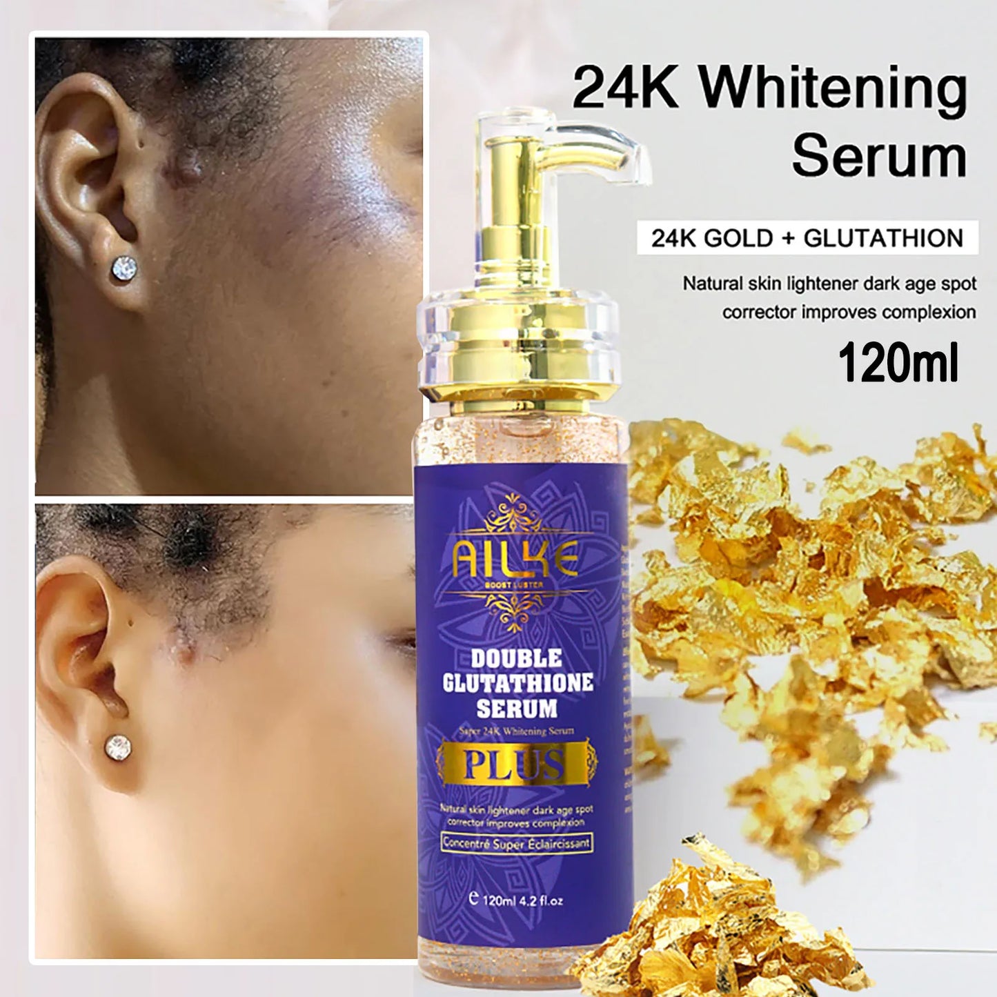 Skin Haven Radiance Boost Serum for skin brightening, featuring a sleek bottle with a dropper, designed to reduce dark spots and even skin tone