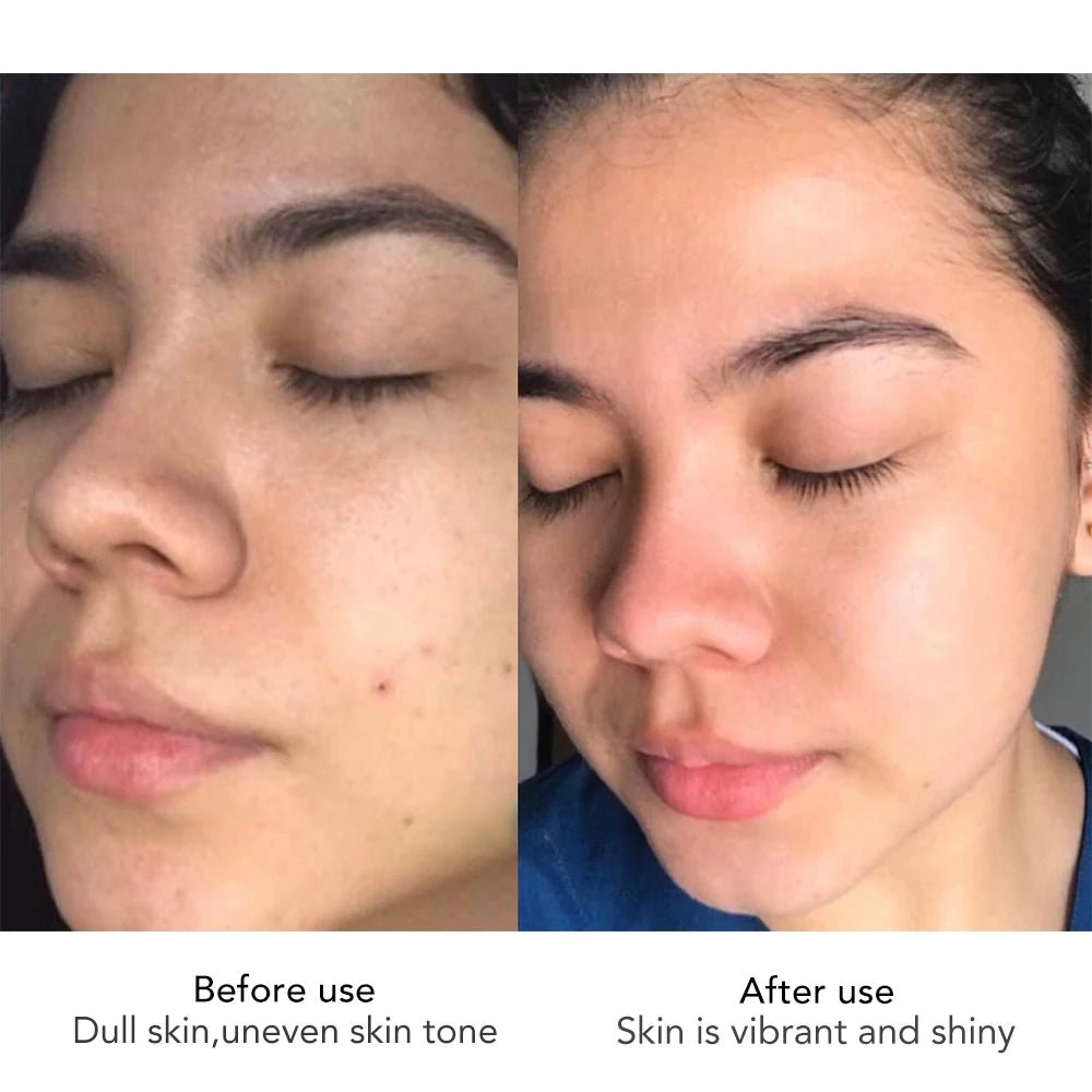 Hyaluronic Face Cream Whitening & Anti-Aging Moisturizer