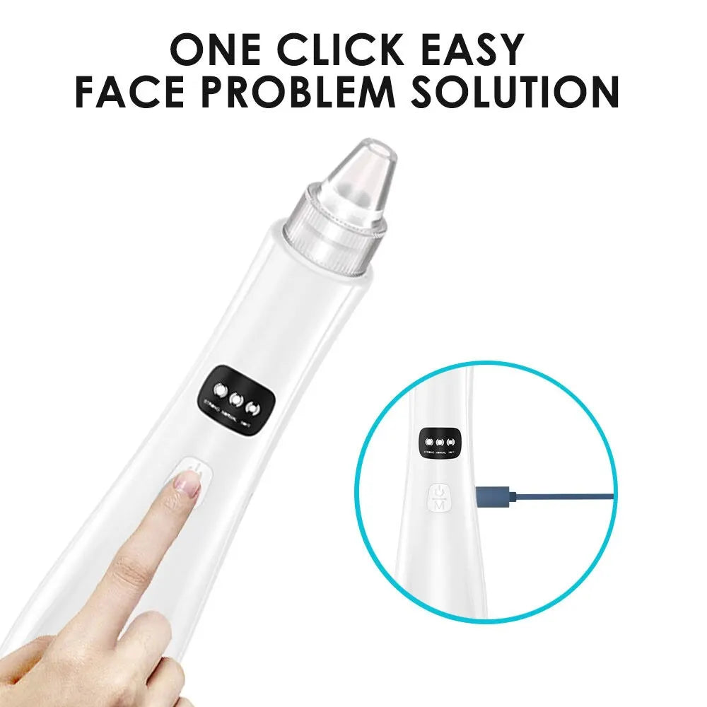 Electric Blackhead Remover Vacuum – 3-Mode Pore Cleanser
