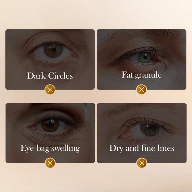 Peptide Caffeine Anti-Wrinkle Eye Cream – Anti-Dark Circles