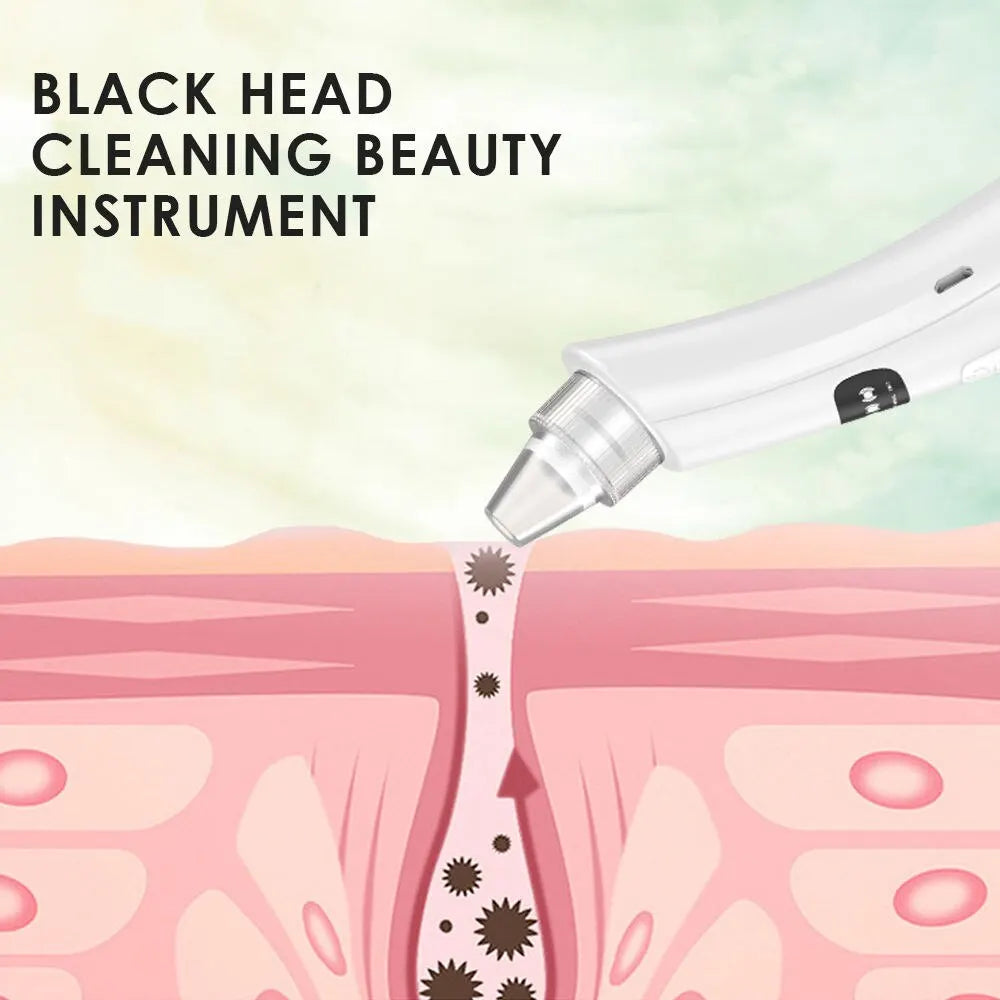 Electric Blackhead Remover Vacuum – 3-Mode Pore Cleanser