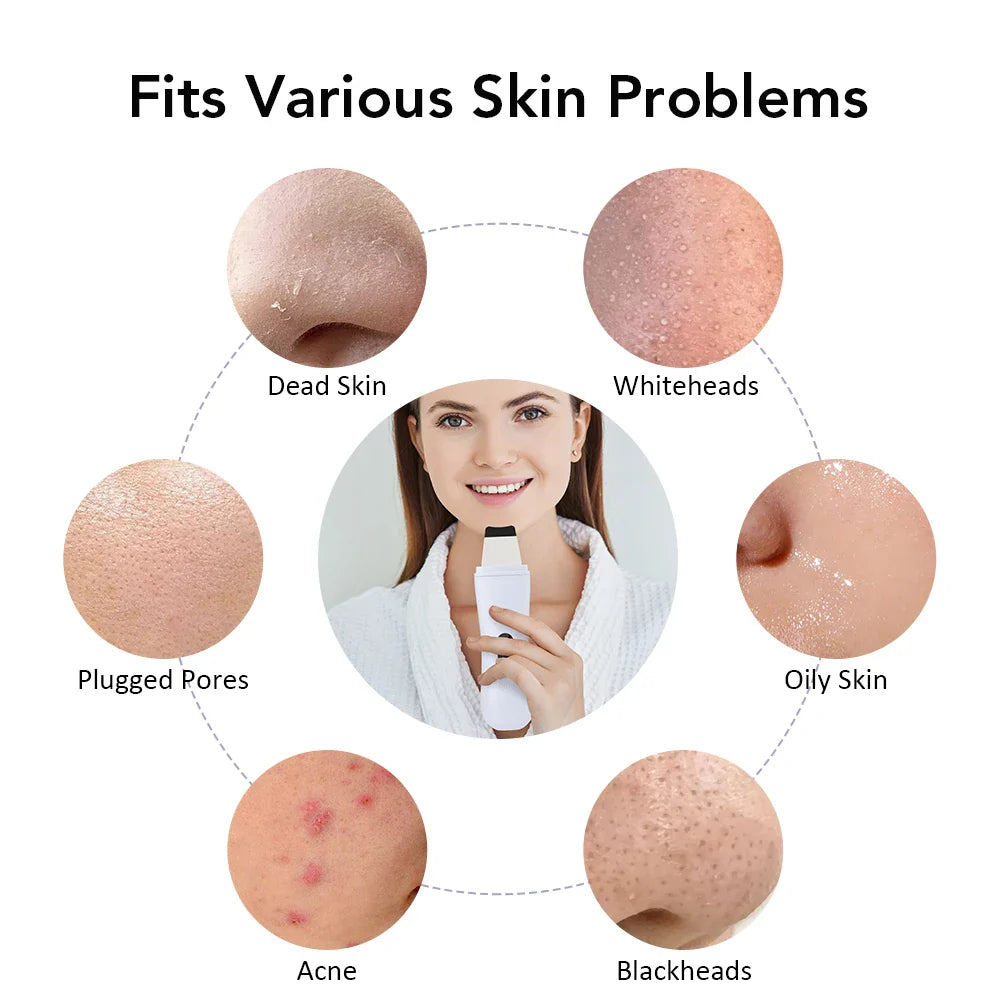 Skin Haven Glow Sonic Facial Cleansing Tool, a handheld skincare device with gentle bristles for deep facial cleansing and exfoliation.
