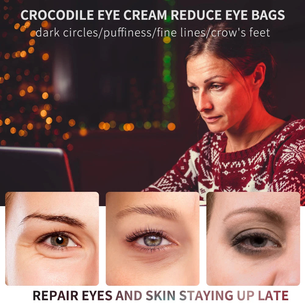 Peptide Collagen Eye Cream – Moisturizing 20 ml Care