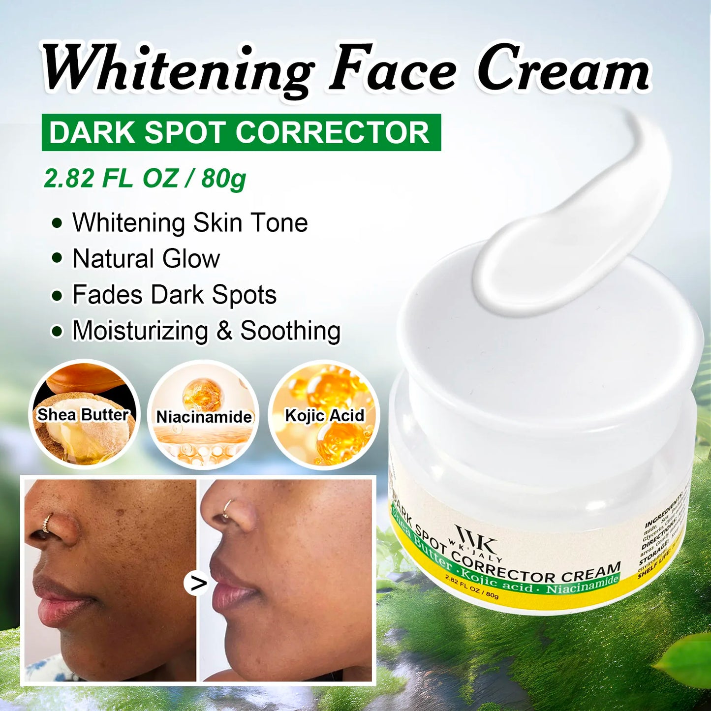 Niacinamide Brightening Skincare Set For Dark Spots