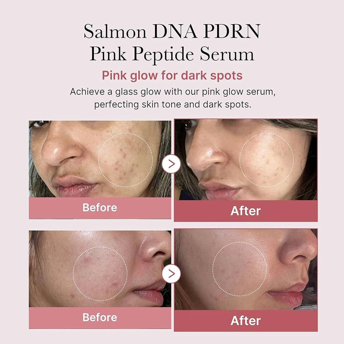 Salmon DNA Pink Peptide Face Serum – Firming & Repair