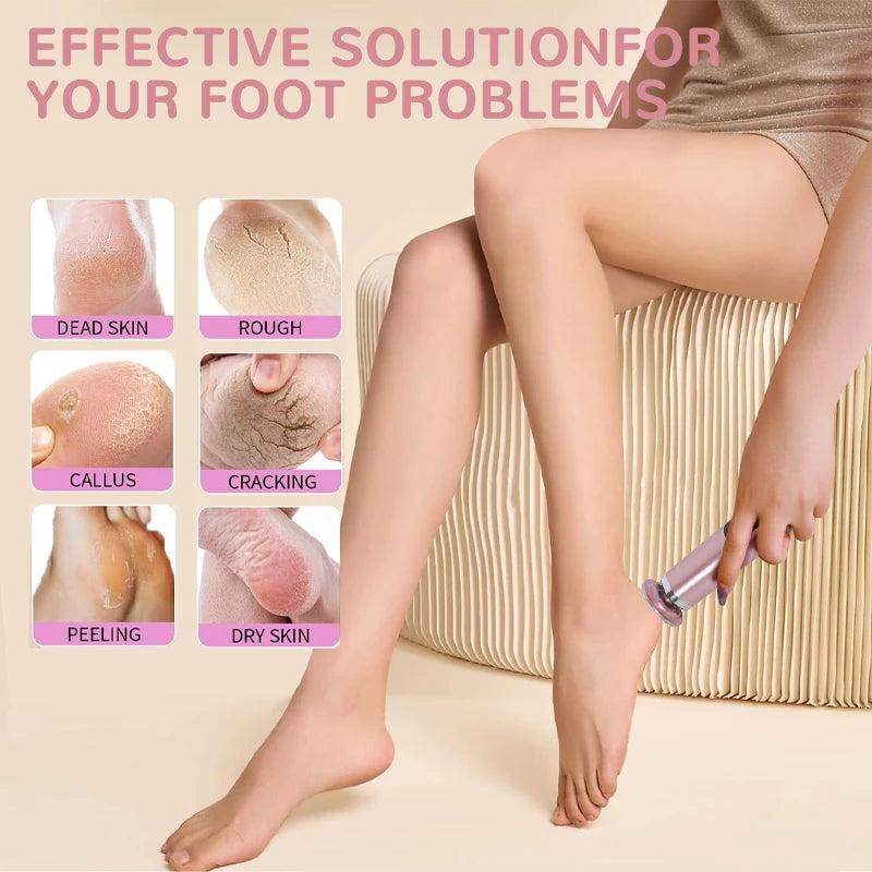 Electric Foot Callus Remover – 2-in-1 Pedicure File