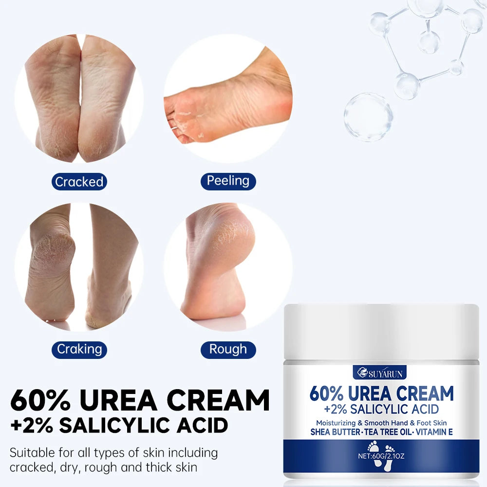 60% Urea Foot Cream for Cracked Heels and Dry Skin