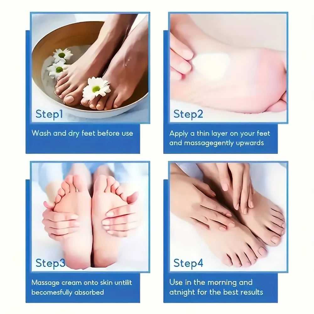 60% Urea Foot Cream for Cracked Heels and Dry Skin