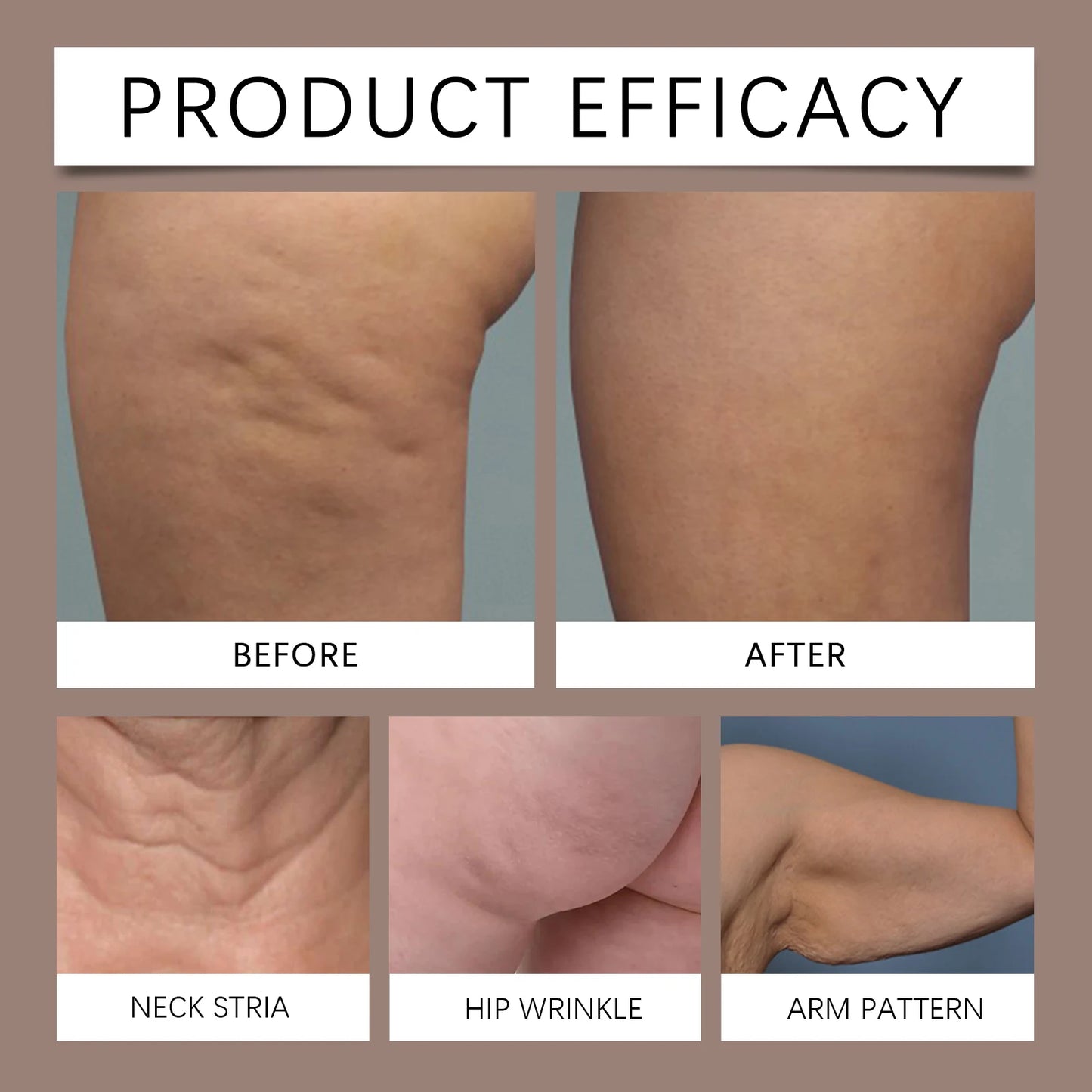 Hydrating Body Treatment Oil For Dry Skin Care