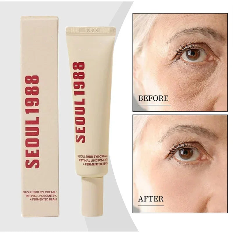 Retinol Eye Cream 4% For Dark Circles And Wrinkles