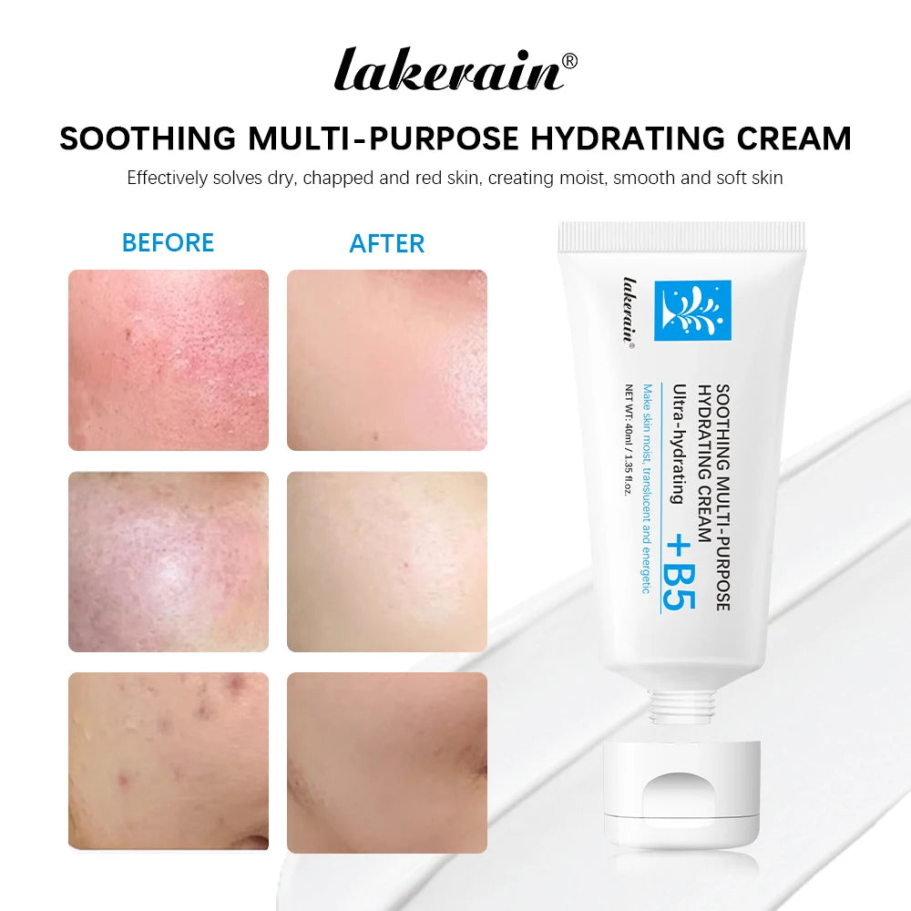B5 Soothing Hydrating Face Cream – Redness Relief