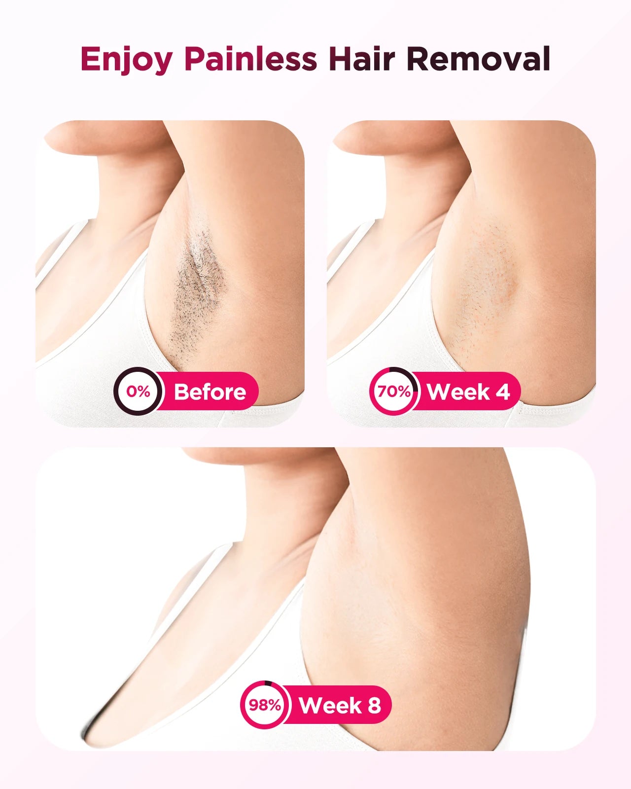 IPL Laser Hair Removal Device – 999,900 Flashes, At-Home Use