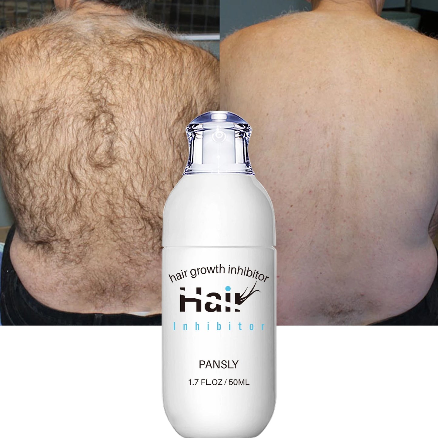 Hair Removal Spray & Growth Inhibitor Set 100 ml