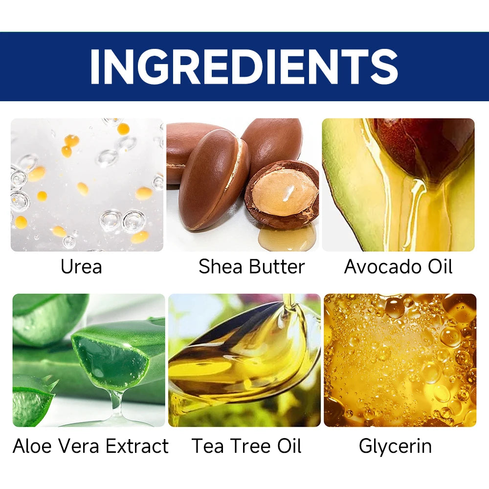 60% Urea Foot Cream for Cracked Heels and Dry Skin
